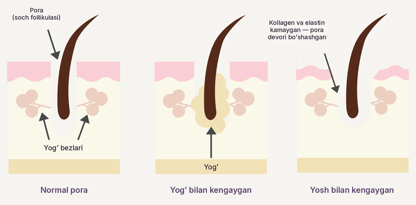 Normal va kengaygan poralar