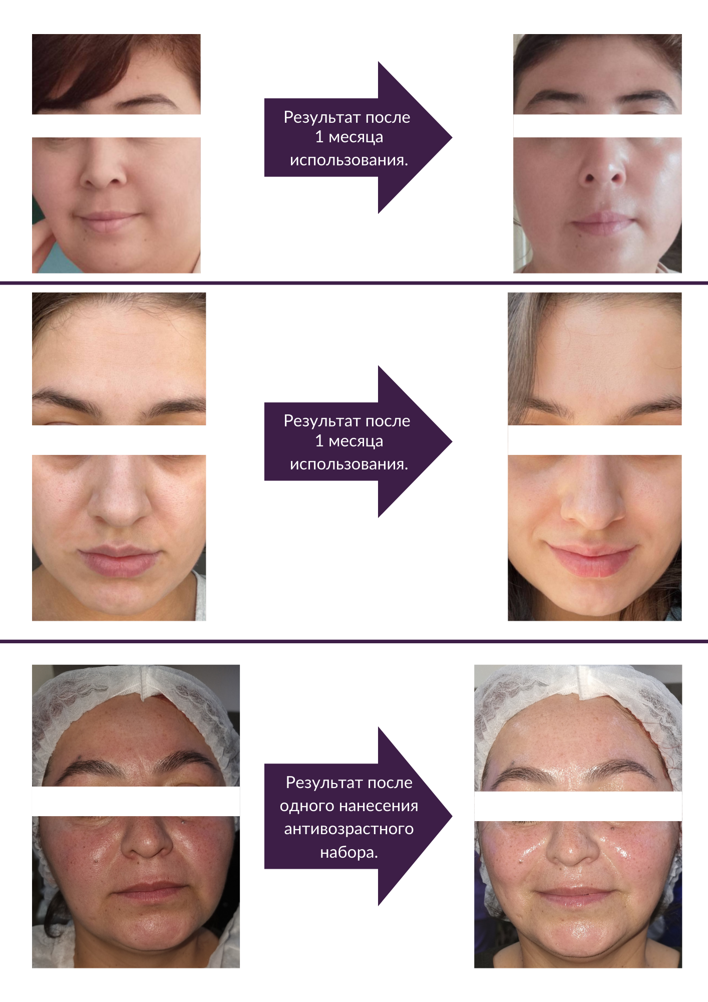 Before - After
