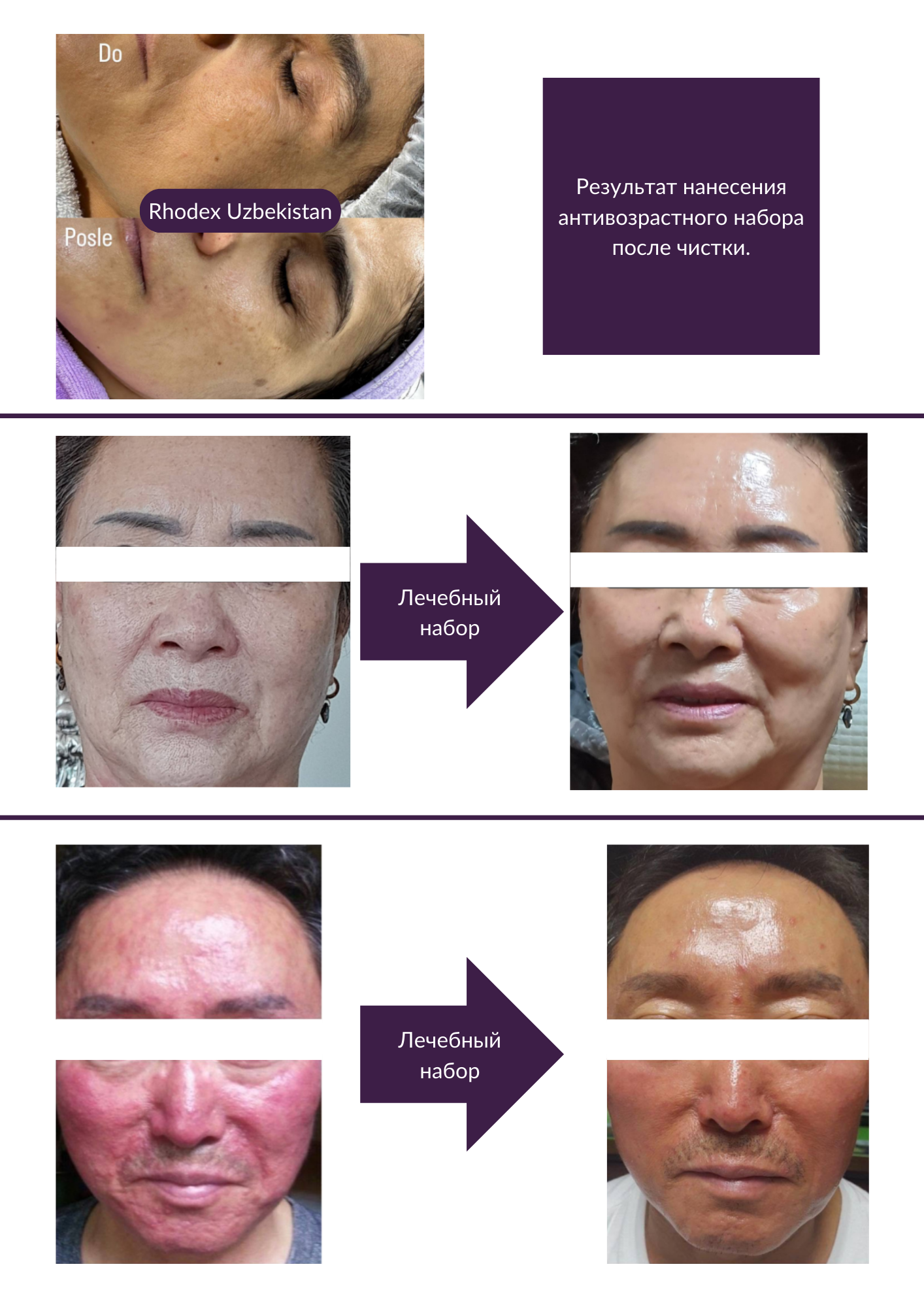 Before - After