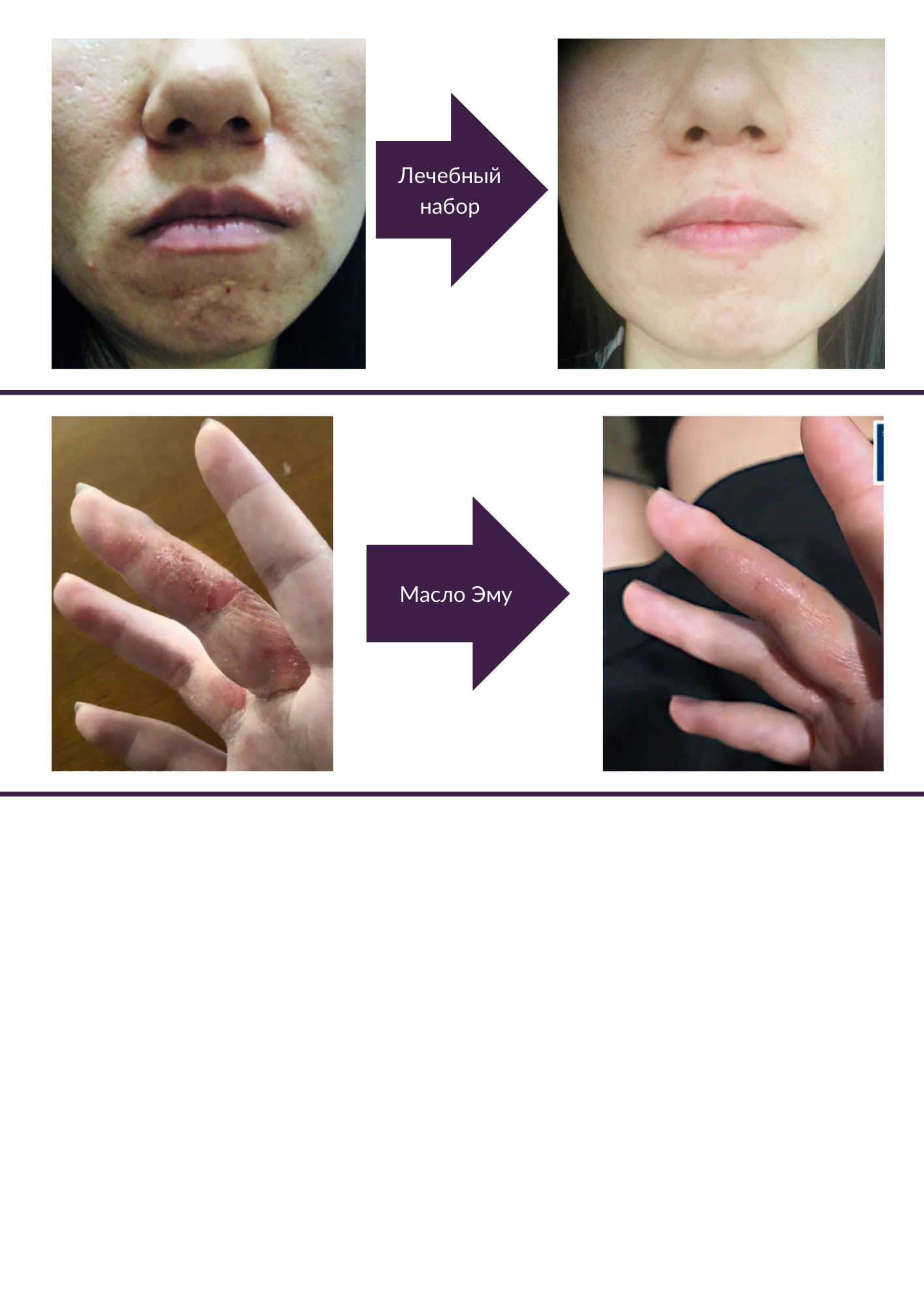 Before - After
